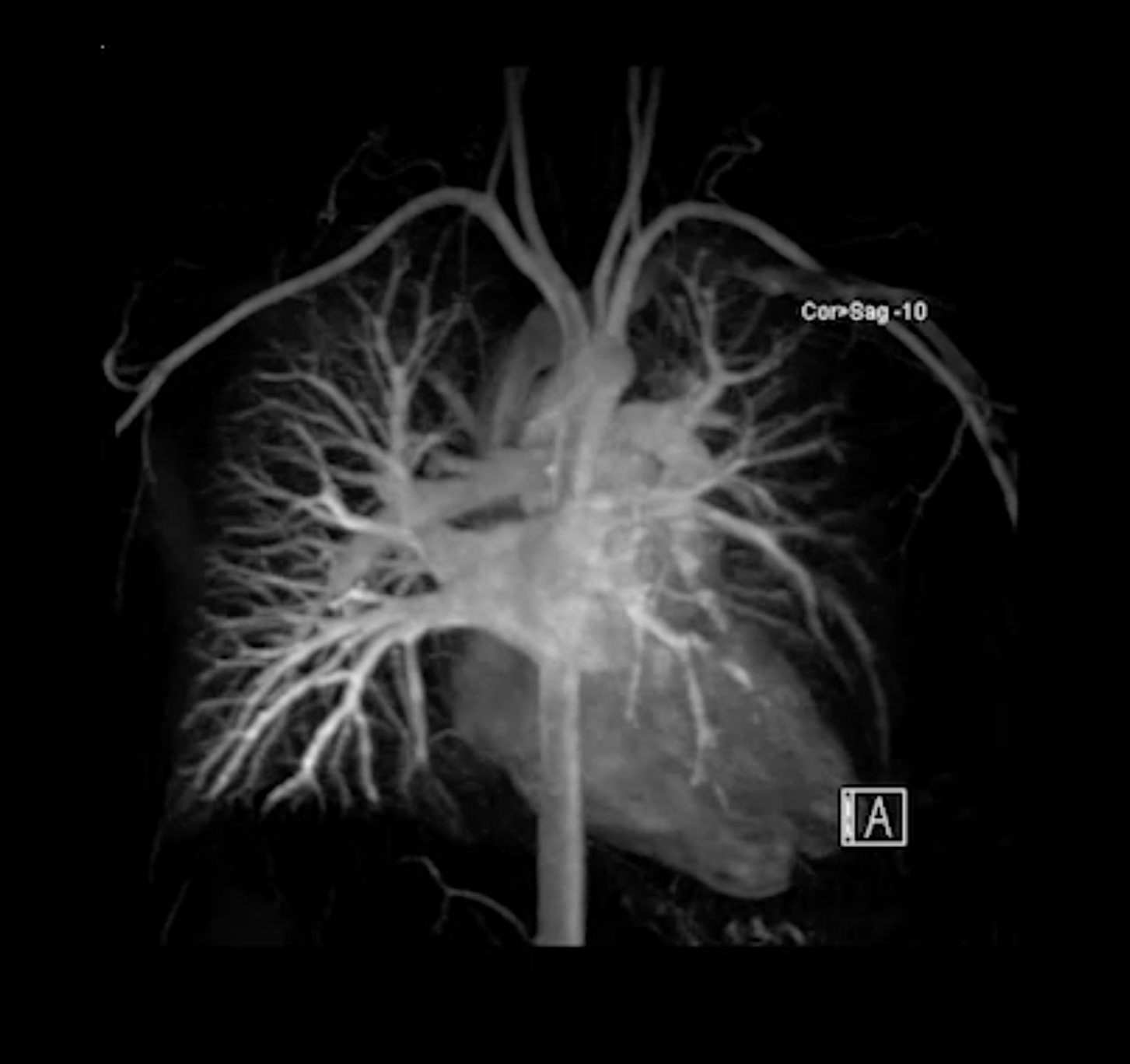 MRI Sample Imagery Z.LeBrun, video, 2023